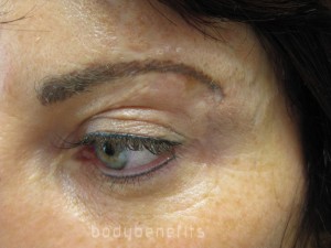 After Eyelid, Eyebrow & Skin Camouflage with Permanent Cosmetics