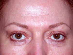 Brows after Permanent Cosmetic Enhancement