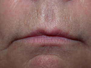 Lips before Permanent Colour