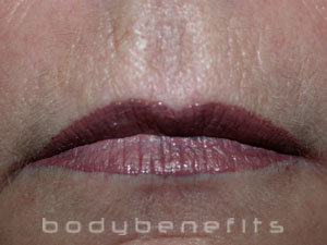 Lips after Permanent Lip Colour